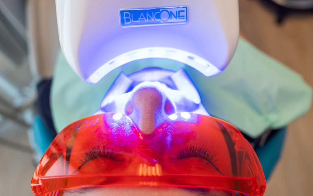 Come avere denti bianchi: i consigli del tuo dentista a Novara