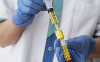 PRP infiltrazioni: cosa sono, come funzionano e quando sono davvero utili